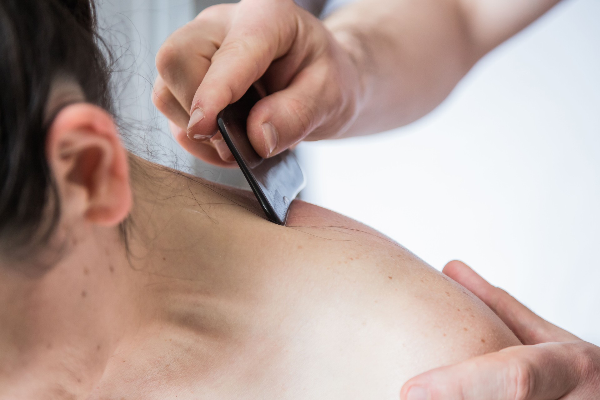 Young Caucasian Woman Getting Body Treatment. Therapist doing skin scrape technique. Chinese technique, gua sha, for pain relief and treatment and activating blood circulation. Stimulus therapy.