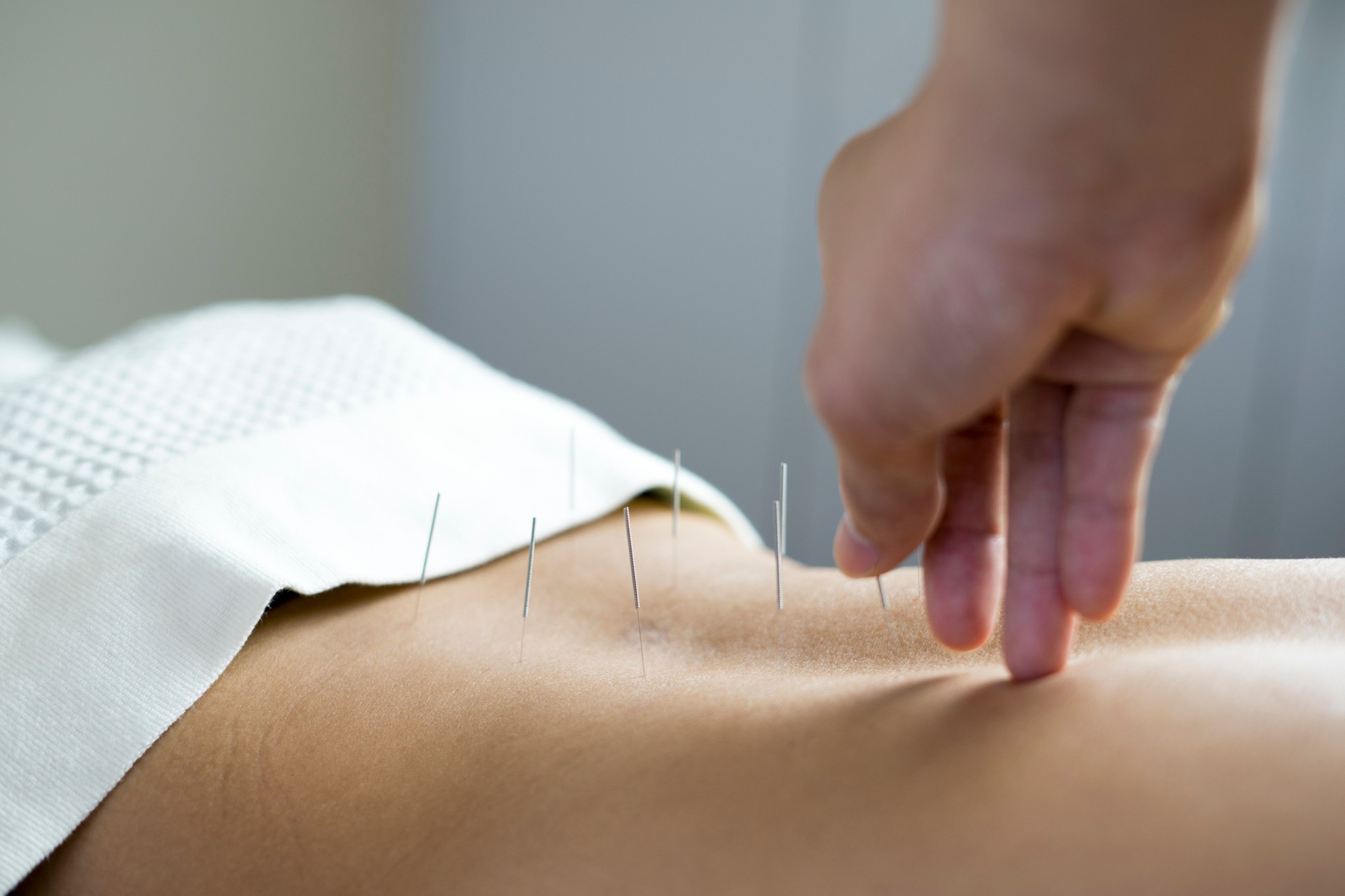 traditional acupuncture treatment